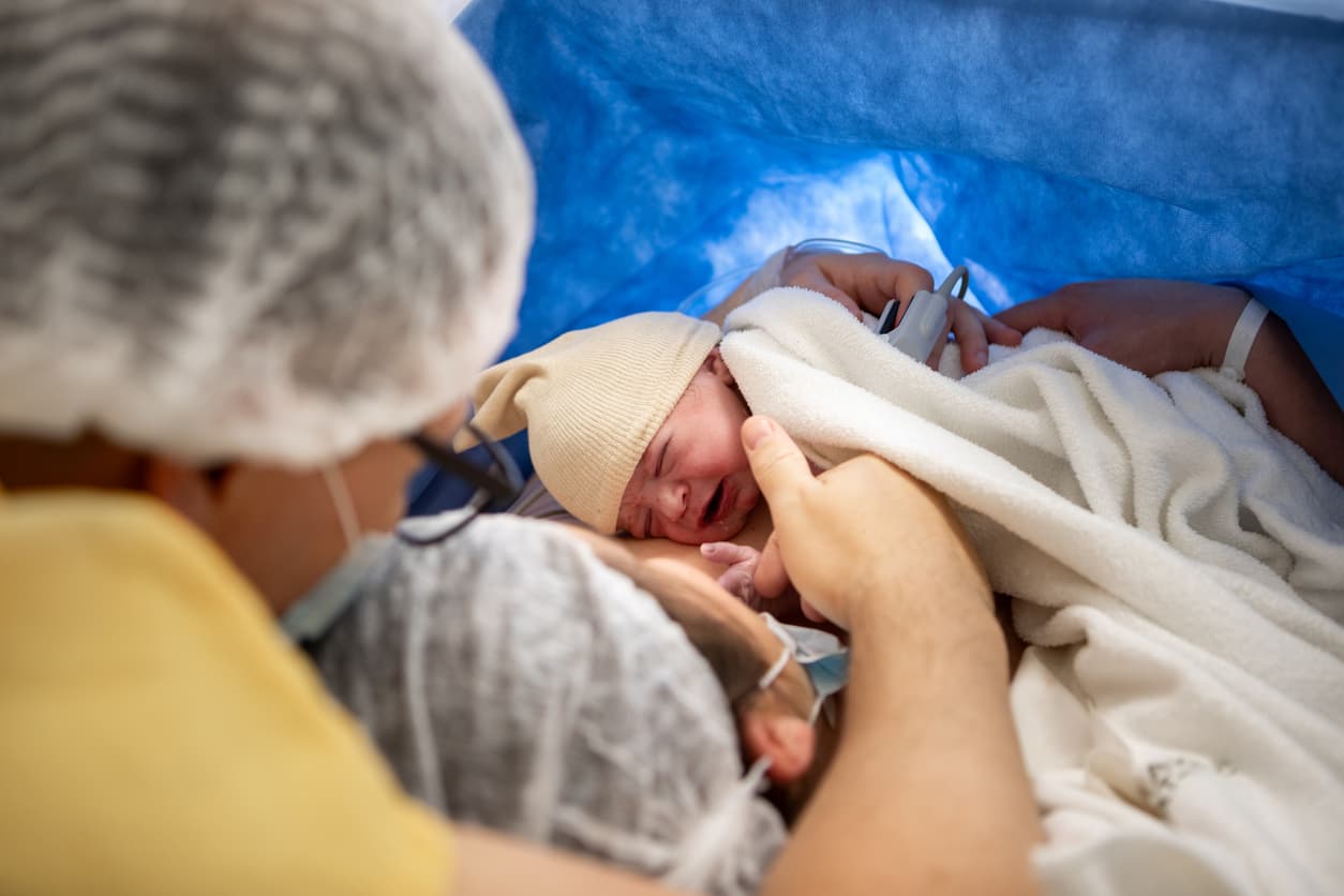 Understanding C-Section Risks: What Every Expectant Mother Should Know