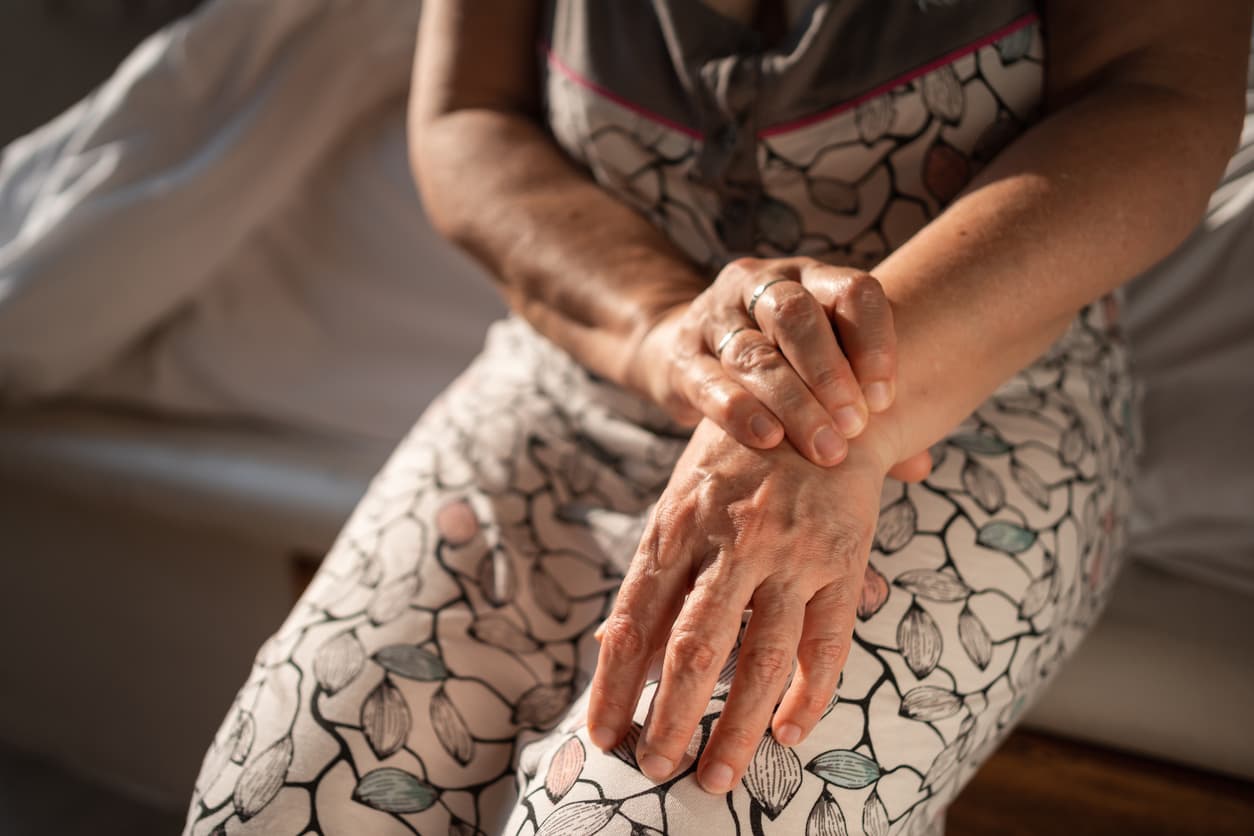 managing rheumatoid arthritis costs-image